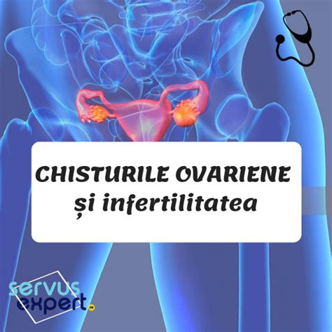 chisturi ovariene poze|Chist ovarian: Cauze, tipuri, simptome si tratament